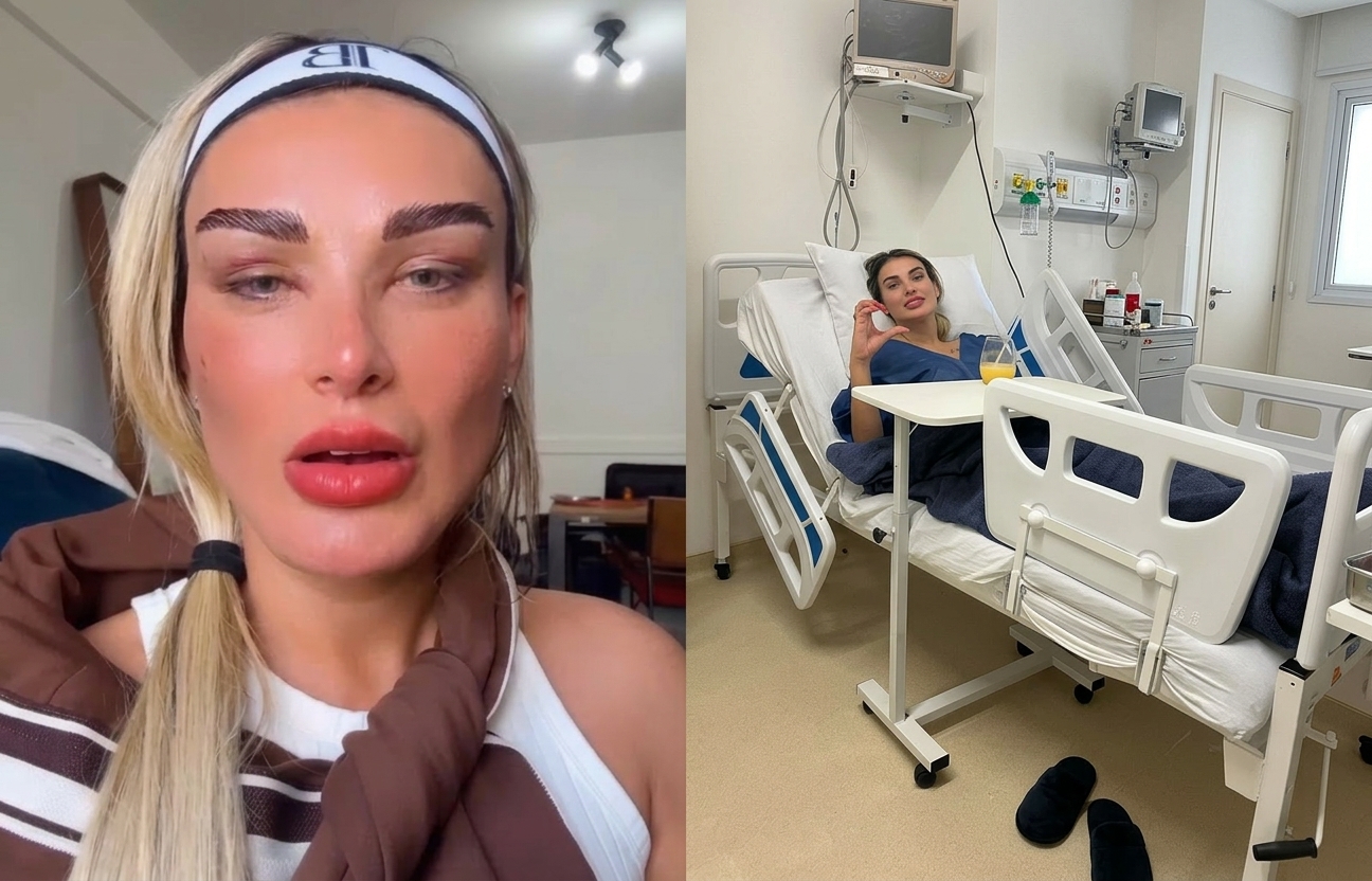 Andressa Urach revela resultado da 69ª cirurgia após transplante de 760 fios nas sobrancelhas